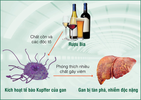 RƯỢU – BIA VÀ MỐI LIÊN QUAN VỚI BỆNH GAN