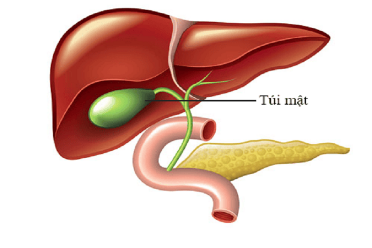 BỆNH VIÊM TÚI MẬT